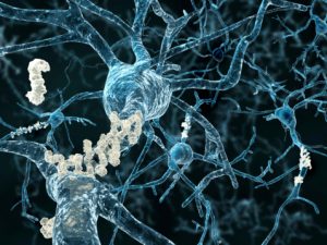 TAU Protein and Wandering in Alzheimer's