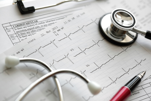 Coronary artery spasm (Prinzmeta...