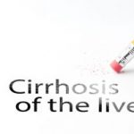 possible-complications-of-cirrhosis-of-the-liver