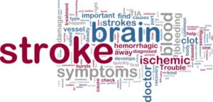 Understanding silent stroke, a leading cause of vascular dementia