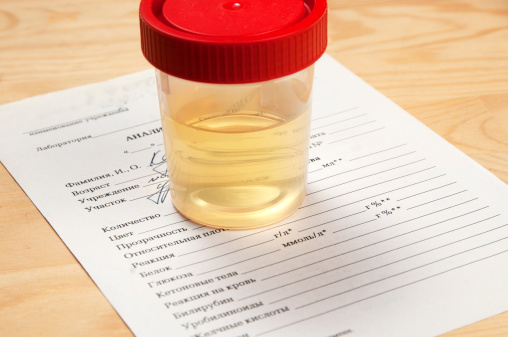 24-hour urine protein test: Coll...