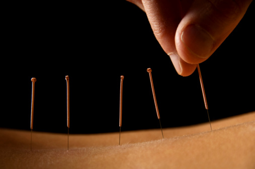 Acupuncture increases effect of ...