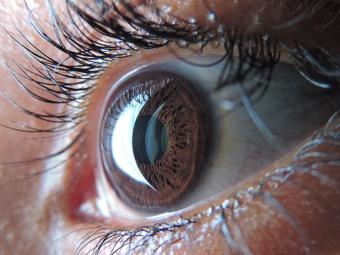 Detached retina: Causes, symptom...