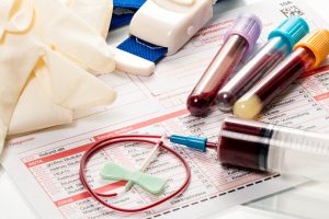 Dialysis testing methods found inconsistent