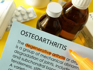 Osteoarthritis (degenerative arthritis)