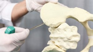 Osteomyelitis (bone infection)
