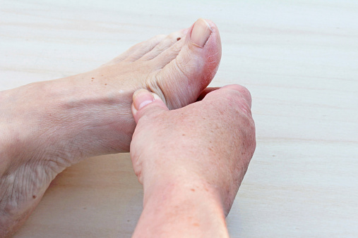 Rheumatoid arthritis and feet: T...
