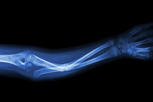 Stem cell technique may aid in b...