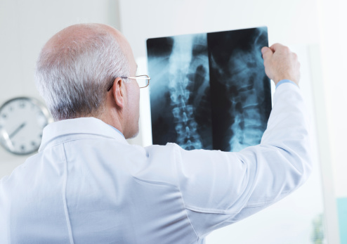 Osteopenia (bone loss) update: N...