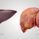 4 ways to improve liver function