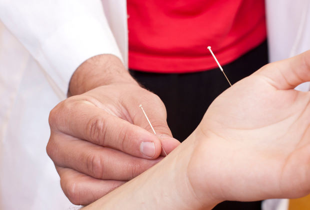 Acupuncture effective in treatin...