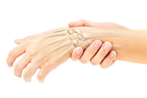 Arthritis affects millions of Am...