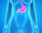 Bile reflux: Home and herbal remedies