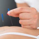 Endometriosis pain relief with acupuncture, white blood cell study opens new treatment opportunity