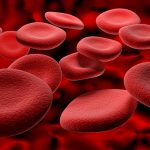 hemoglobin-leak-linked-to-brain-shrinkage-in-multiple-sclerosis