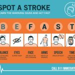 Massive stroke: Signs, treatment, and recovery tips
