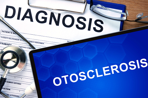 Otosclerosis (or otospongiosis) ...