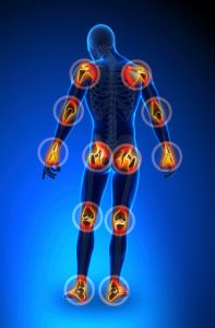 How to deal with arthritis pain on a daily basis