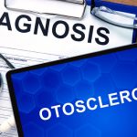 Otosclerosis (or otospongiosis) hearing loss: Symptoms, causes, and treatments
