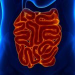 Crohn’s disease vs. diverticulitis: Causes, symptoms, risk factors, and complications