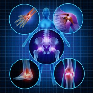 Polyarthritis: Causes, symptoms, and treatment
