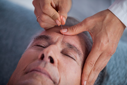 Acupuncture is effective pain re...