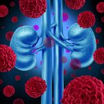 Immune system opdivo kidney cancer survival