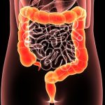Simple tips to keep your colon clean