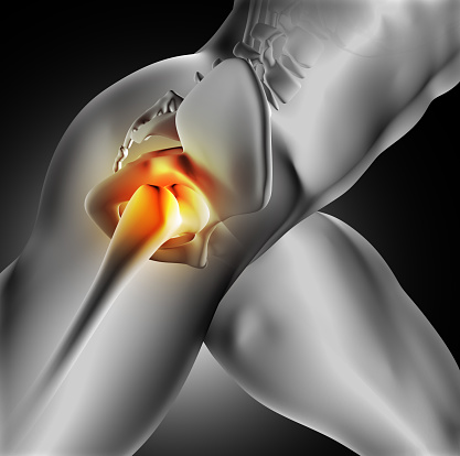 Weekly health news: Iliac crest ...