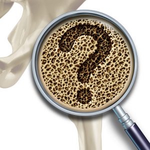 osteopenia vs. osteoporosis