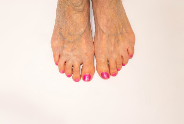 Weekly health news: Poor circula...