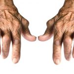 Rheumatoid arthritis risk in women with post-traumatic stress disorder (PTSD) higher, study shows