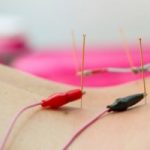 Acupuncture-Lowers-Hypertension