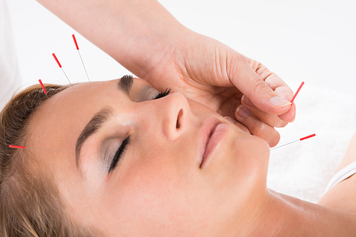 Acupuncture study finds real evi...