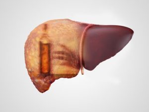 tips for a healthy liver
