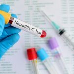 Hepatitis C screening recommended for baby boomers, as they face higher viral infection risk