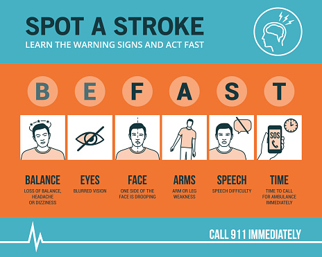 Stroke update: Massive stroke, s...