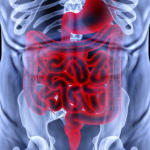 Swollen colon: Causes and symptoms