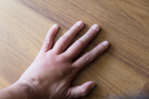 What causes swollen knuckles and...