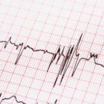 atrial-fibrillation-in-older-adults