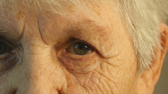 What eye freckles reveal about y...