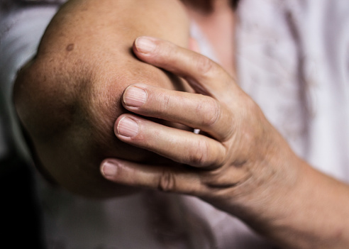 How to treat elbow arthritis: Ca...