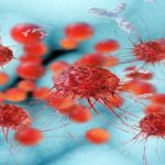 Ovarian cancer recurrence reduced with combination therapy