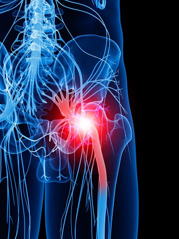 What causes causalgia? Symptoms,...