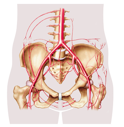 Leriche syndrome (aortoiliac occ...
