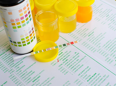 What is Ketonuria? Causes, Symptoms, Diagnosis, Treatment and Prevention