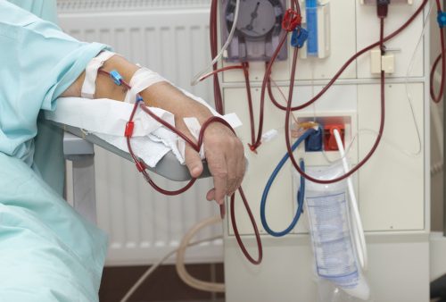 What Is The Life Expectancy With Stage 4 Kidney Disease Symptoms Treatment And Diet