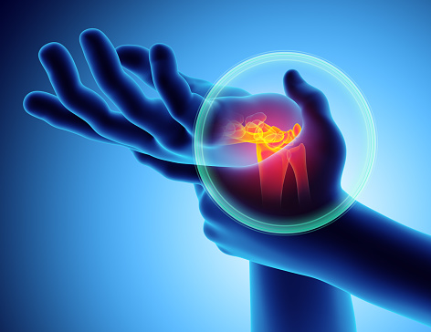 What causes migratory arthritis?...