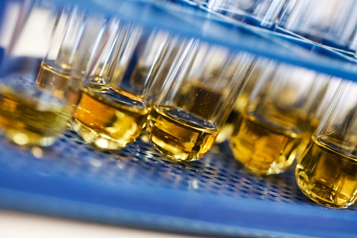 Uremia, a complication of chroni...