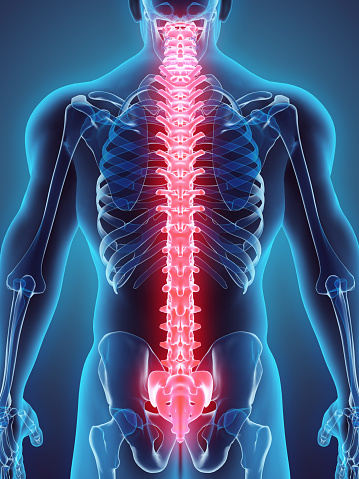 Spinal stroke: Causes, symptoms ...